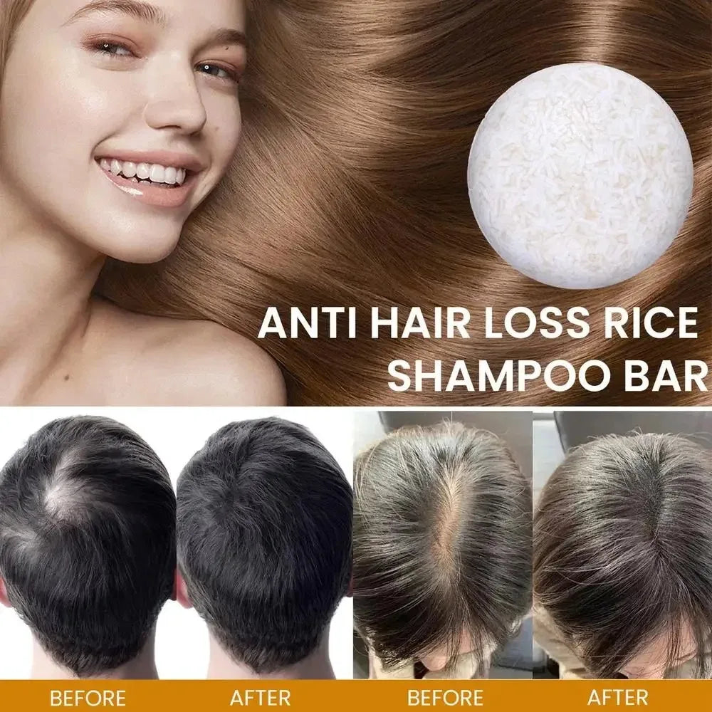 Organic Rice Shampoo Soap Bar Oil Free Conditioning Soap Rice Water Protein Nourishing Anti-loss Hair Hair Growth Soap Bar Oasis Select