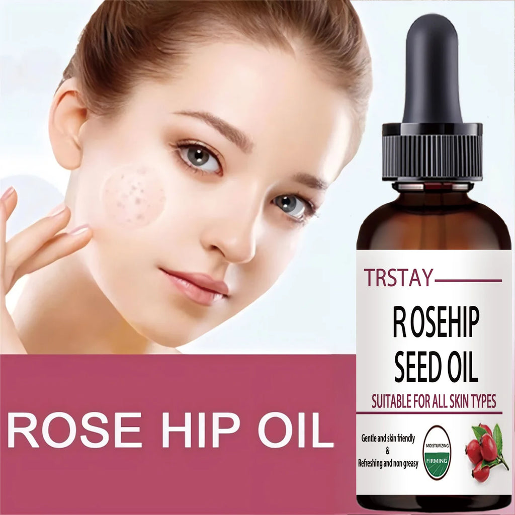 5ML/15ML/30ML/50ML/Pure Essential Oils Rosehip Oil Moisturizing Brighten Skin Color Essential Oil Anti-Dry Anti-Aging Face Essen Oasis Select