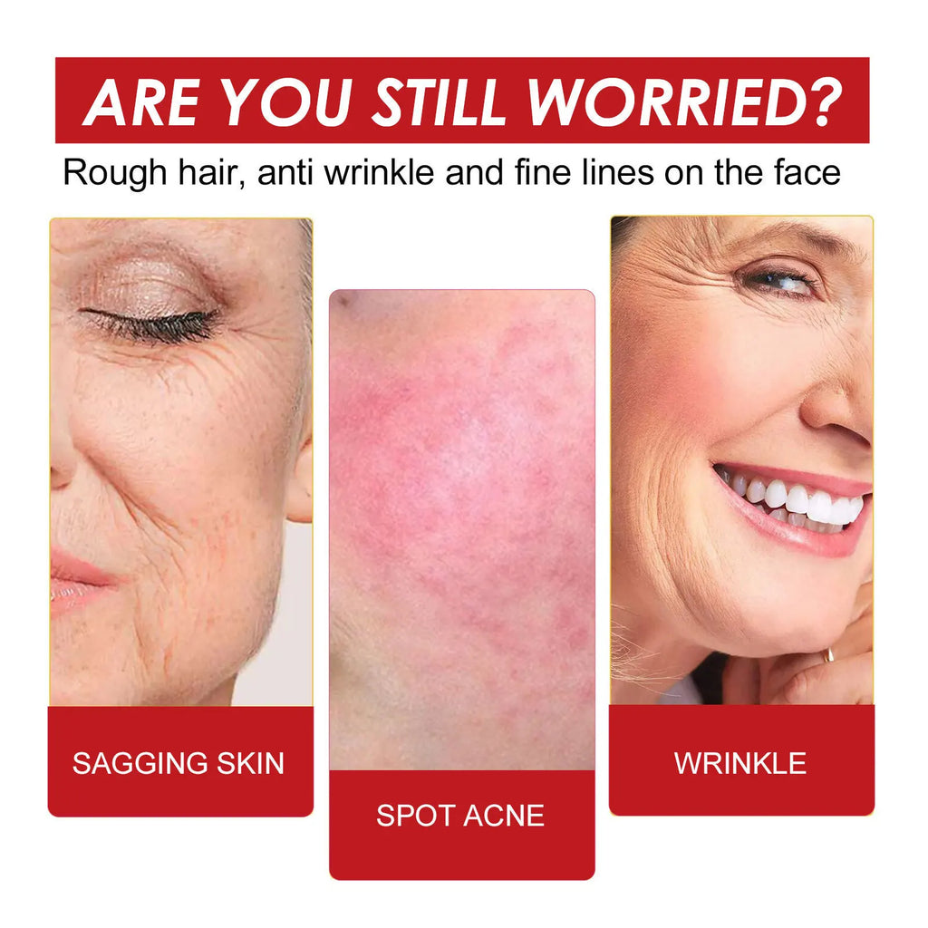 30ml Rosehip Oil Facial Serum Moisturizing and Fading Wrinkles Organic Face Serum Fine Pore Anti-aging Essential Oil Oasis Select