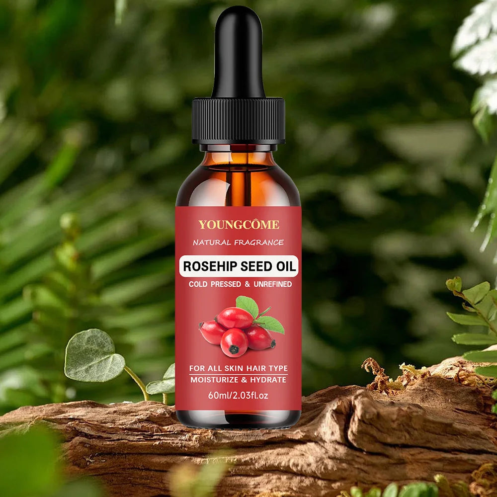 YOUNGCOME Rosehip Seed Oil – Face, Gua Sha & Hair Care Rosehip Face Oil Oasis Select