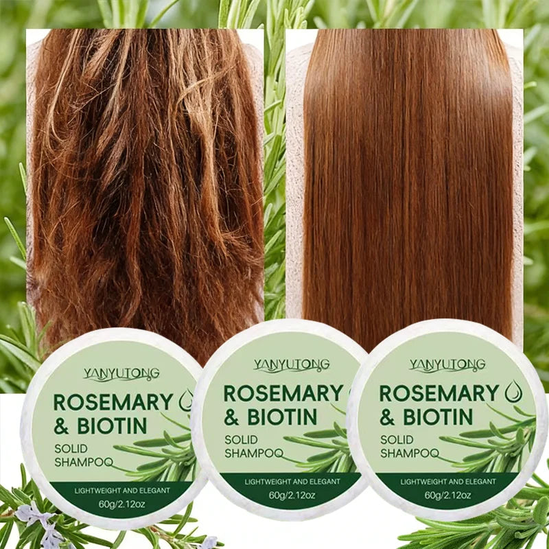 Rosemary Shampoo Soap: Deep Cleansing, Moisturizing and Nourishing, Scalp Relief and Oil Control, Hair Growth and Care, Daily Sh Oasis Select