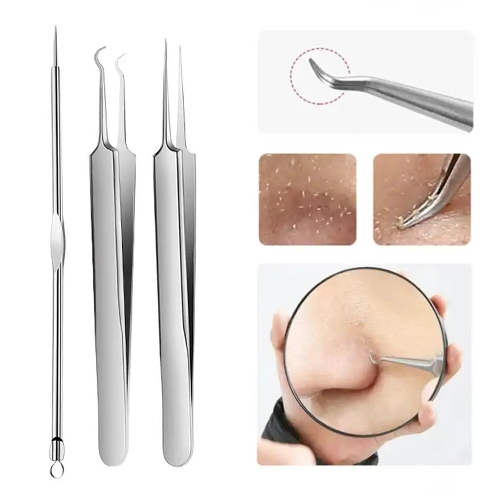 3PCS/kit Acne Needle Blackhead Clip Remover Extraction Pore Black Head Clean Face Skin Care Cleansing Needle Blemish Pick Tool Oasis Select
