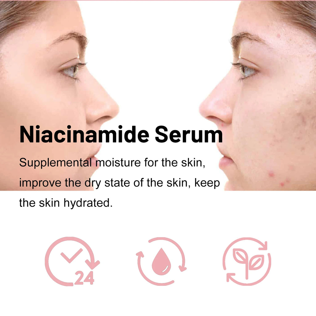 OUHOE Nicotinamide Brightening Face Serum – Anti-Aging 30ml Brightening Face Serum Oasis Select