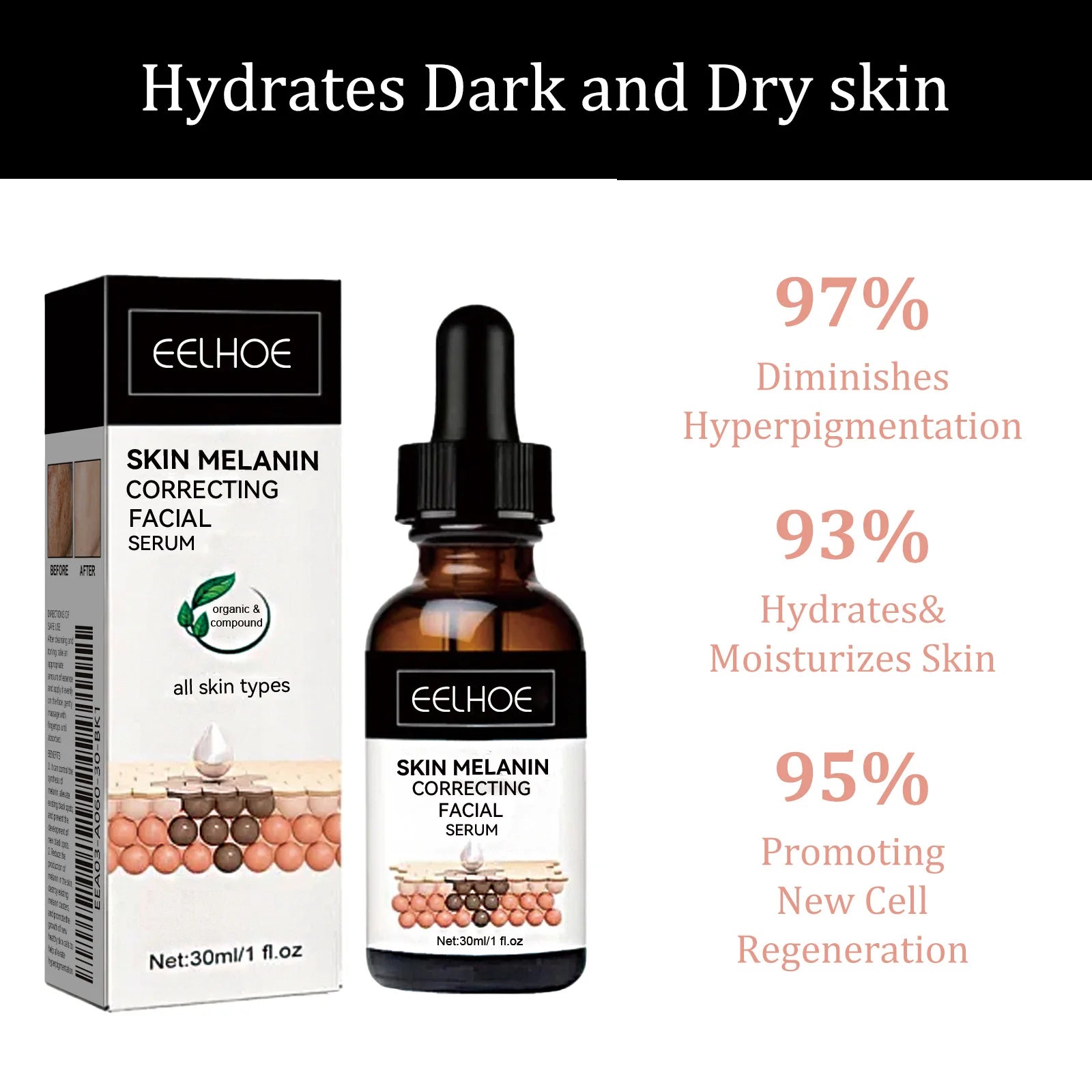Eelhoe Niacinamide Dark Spot Serum – Fade Melanin & Brighten Brightening Face Serum Oasis Select