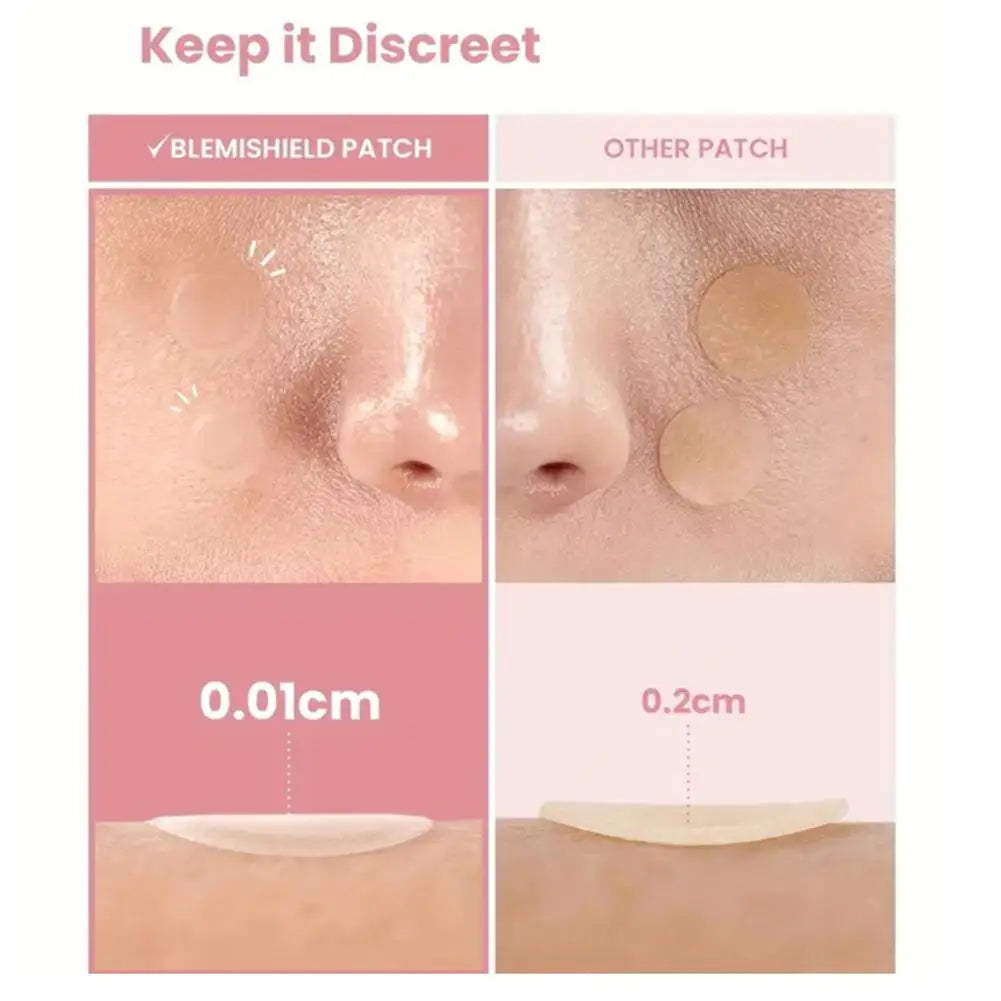 Pimple Patches for Face 360 Counts, Cute Stars Hearts Dots Hydrocolloid Acne Patches for Breakouts Zit Patches Pimple Skin Care Oasis Select