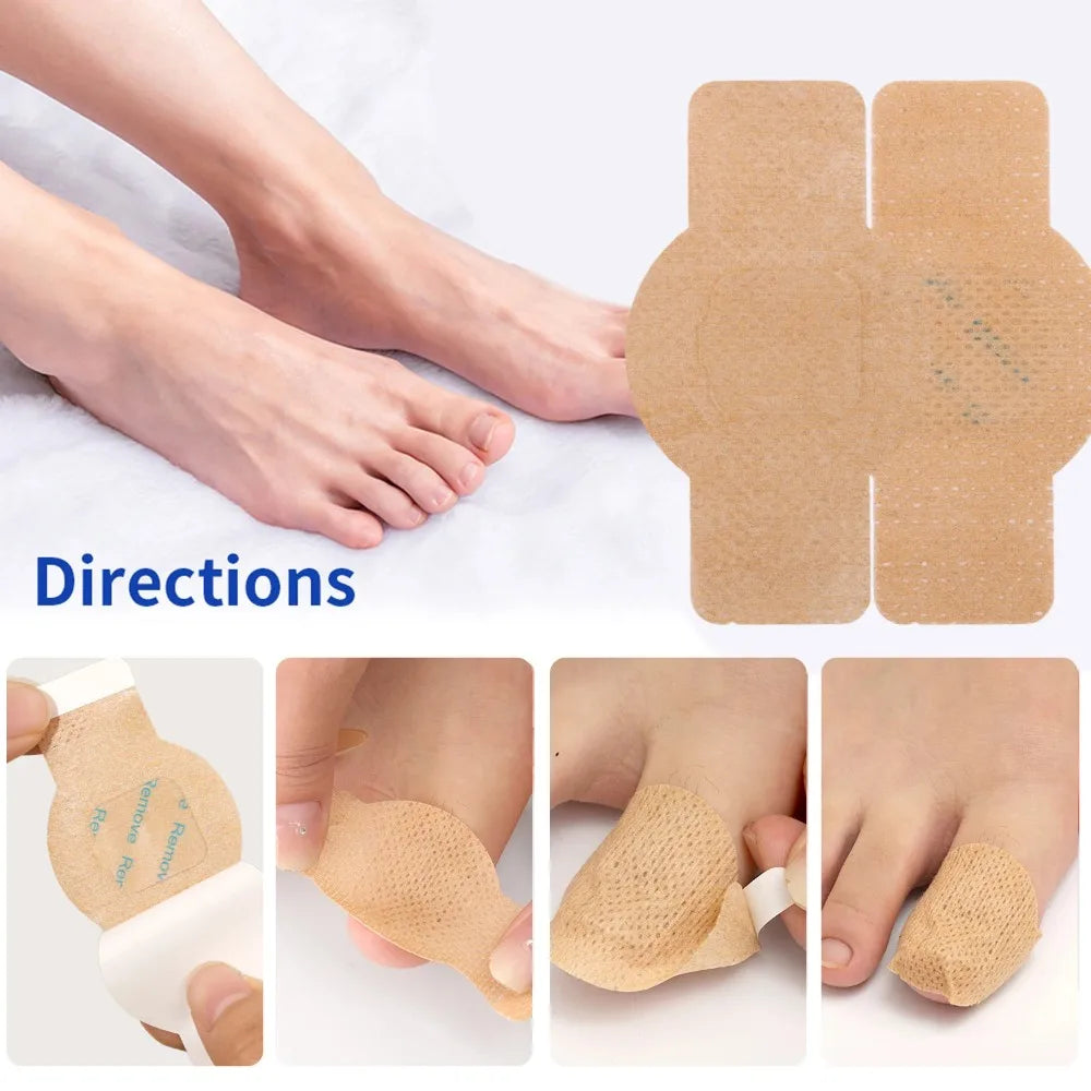 Nail Repair Patches – Ingrown Toenail & Nail Care Stickers Nail Care Patches Oasis Select