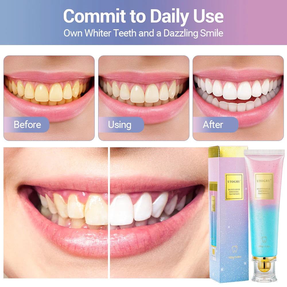 Niacinamide Whitening Toothpaste – 3 Pack | Stain Removal