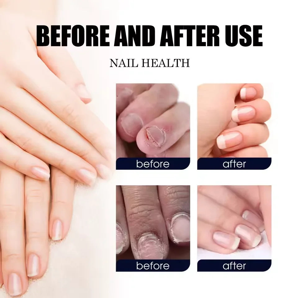 7 Days Nail Repair Serum | Plant Extract Nail Wellness Gel 10ml