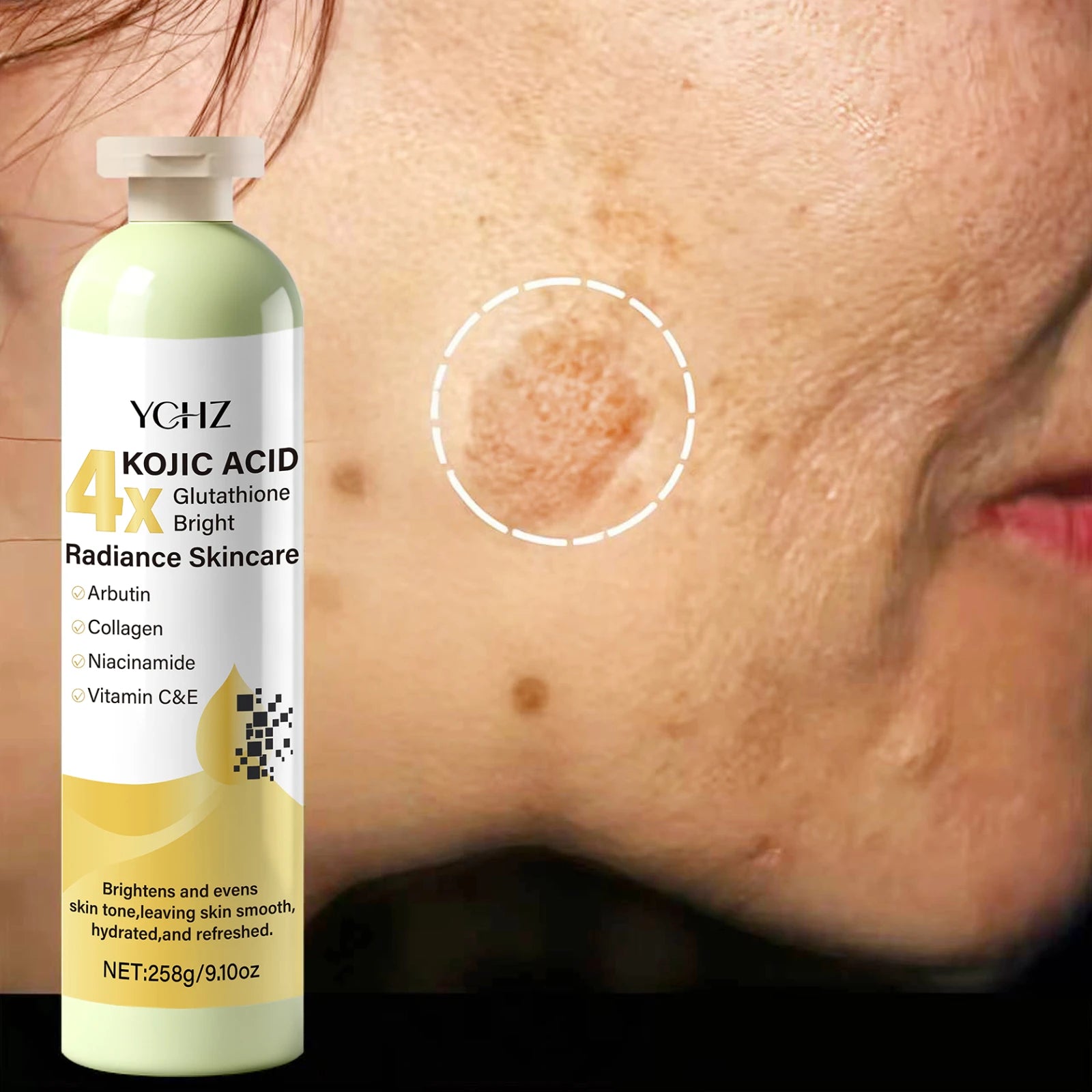 YCHZ Kojic Acid Cream – Dark Spot Corrector & Skin Brightener