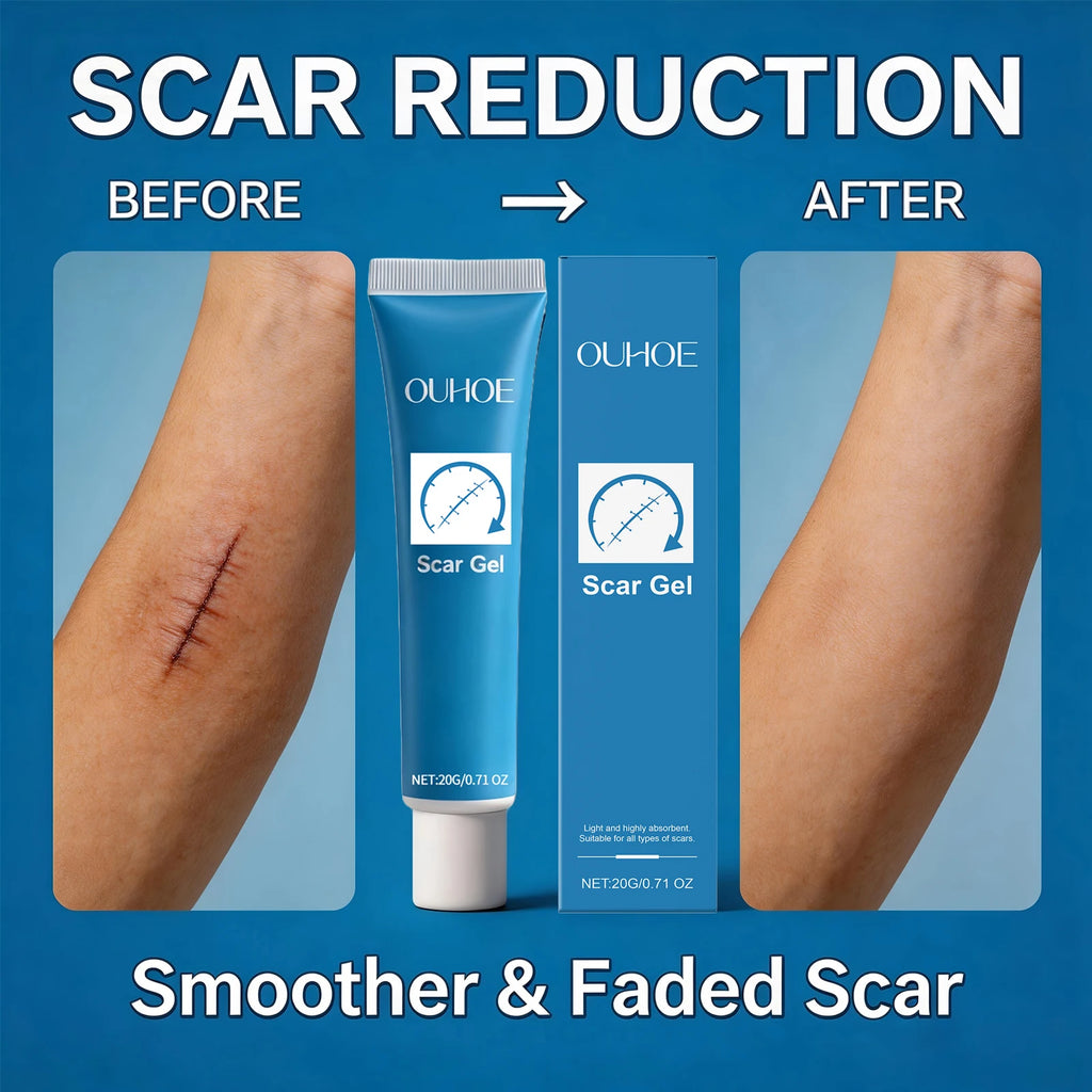 Ouhoe Scar Gel Scar Repair Cream Fade-Out Scald Scar Skin Wound Cream Stretch Marks Acne Marks Repair Gel Skin Care Products Oasis Select