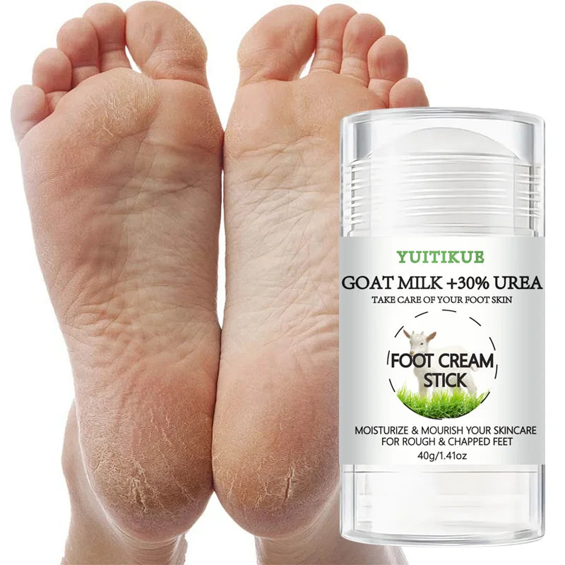 YUITIKUE 30% Urea & Goat Milk Foot Cream Stick – Dry Feet