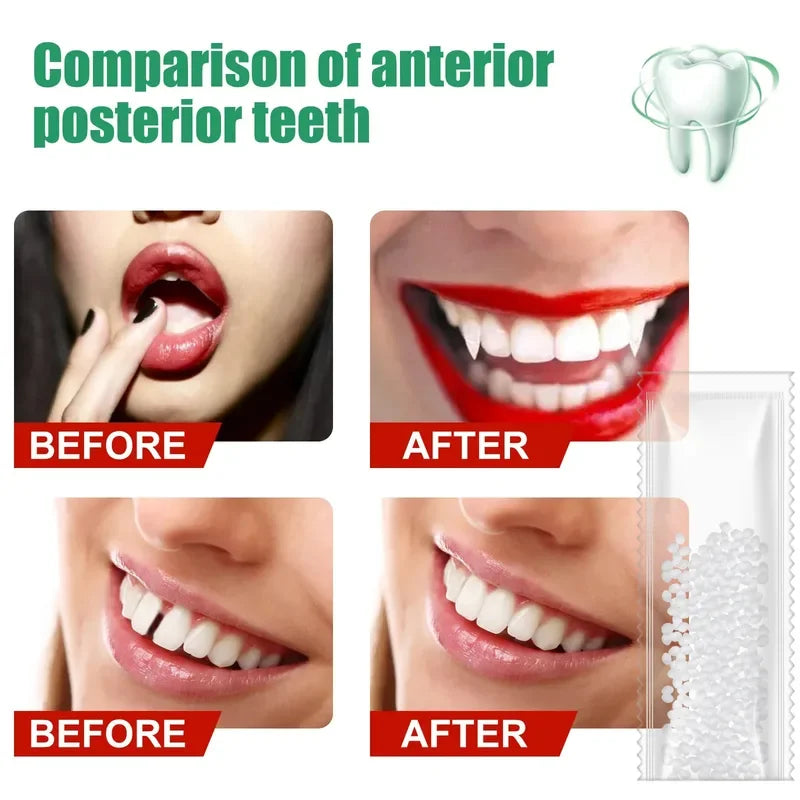 Temporary Tooth Repair Kit Teeth And Gaps False Teeth Solid Glue Denture Adhesive Teeth Whitening Tooth Beauty Oasis Select