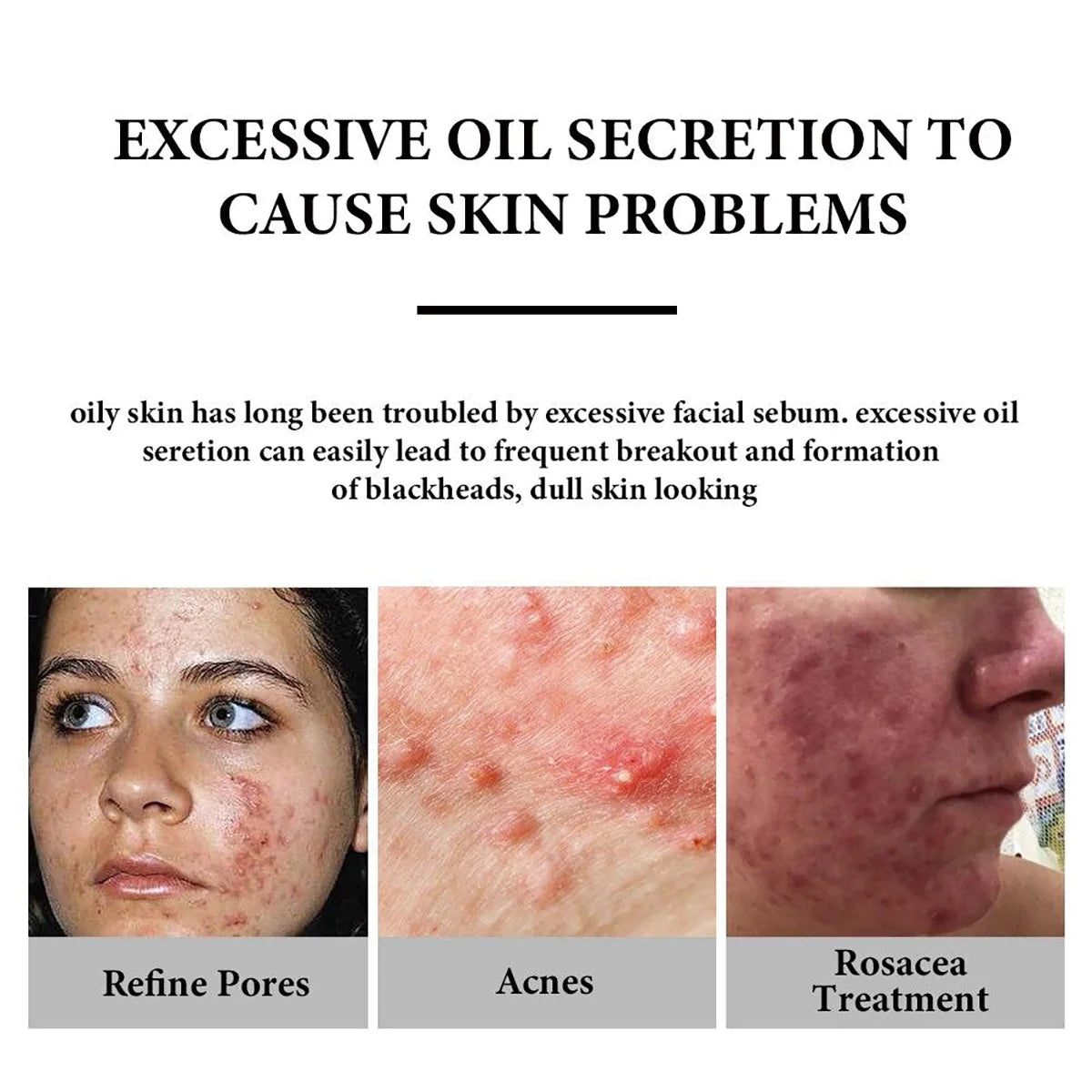 Collagen Complex Serum Face Blemish Skin Repair Essence Moisturizing Firming Improve Facial Elasticity Oasis Select