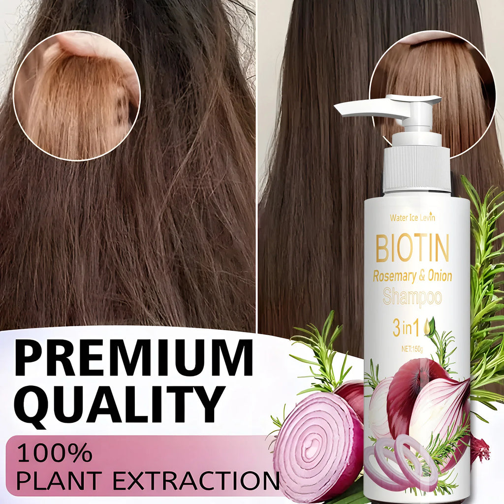 Biotin Rosemary & Onion 3-in-1 Shampoo – Anti-Thinning Hair Hair Growth Shampoo Oasis Select