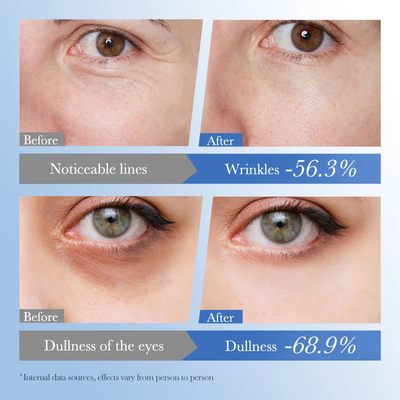 Caviar & Hyaluronic Acid Eye Cream – Firming & Brightening 20g