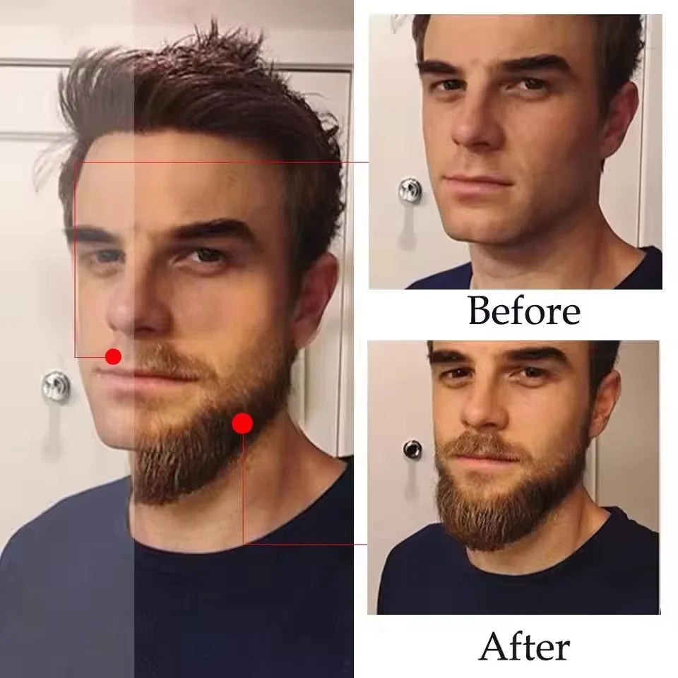 High Quality Fast Beard Growth Serum For Men Promote Beard Regrowth Thicker Longer Fuller Anti Hair Loss Essential Oil Hair Care Oasis Select