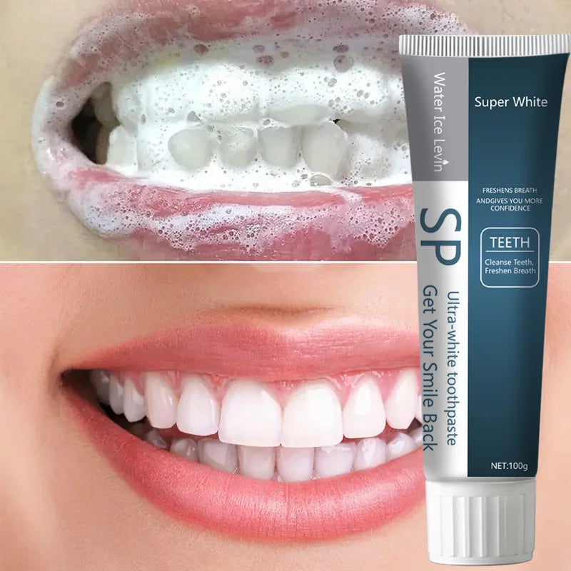 SP Probiotic Whitening Toothpaste – Stain Removal & Fresh Breath Whitening Toothpaste Oasis Select