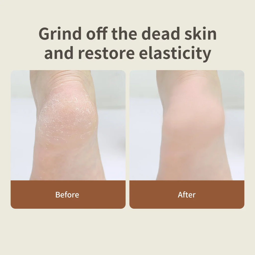DOCO Electric Pedicure Foot Polishing Artifact to Remove Dead Skin Rub Calluses Beauty foot Grinding Stone Knife Home Foot Care Oasis Select