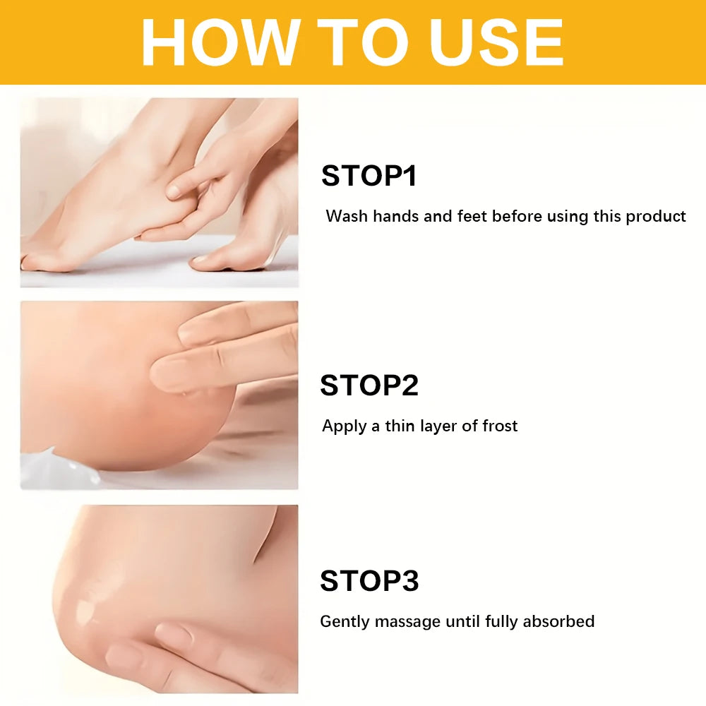 60% Urea & 2% Salicylic Acid Foot Cream for Cracked Heels - Exfoliating, Moisturizing, Hard Skin, Callus & Dead Skin Remover. Oasis Select