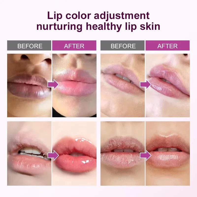 Remove Dark Lip Balm Fast Lightening Pink Lip Exfoliating Fade Lip Line Dead Skin Moisturizer Korean Care Products Beauty Health Oasis Select