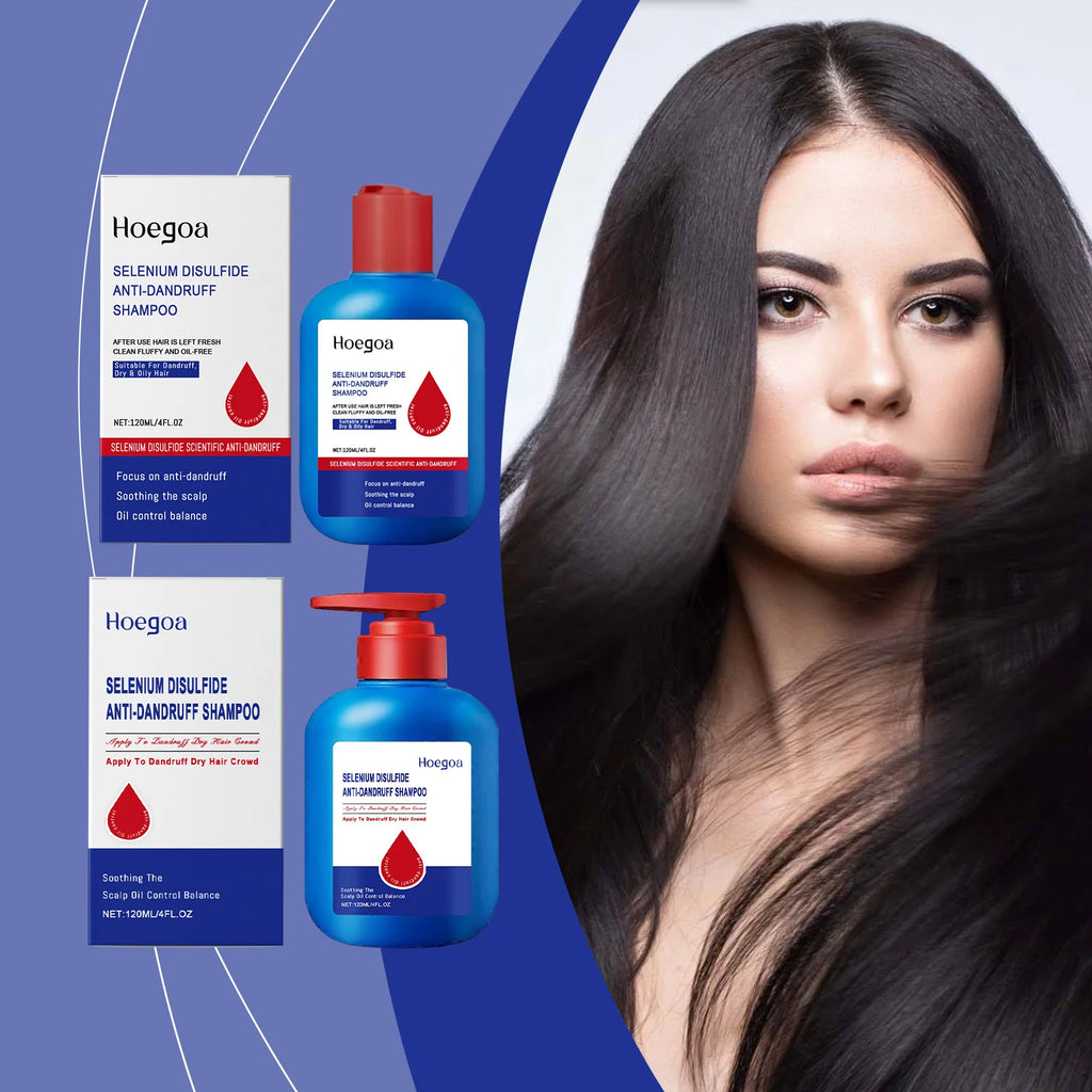 Selenium Sulfide Shampoo Deep Cleansing Remove Dandruff Reduce Scalp Itchy Balance Oil Strengthen Hair Roots Fluffy Hair Shampoo Oasis Select