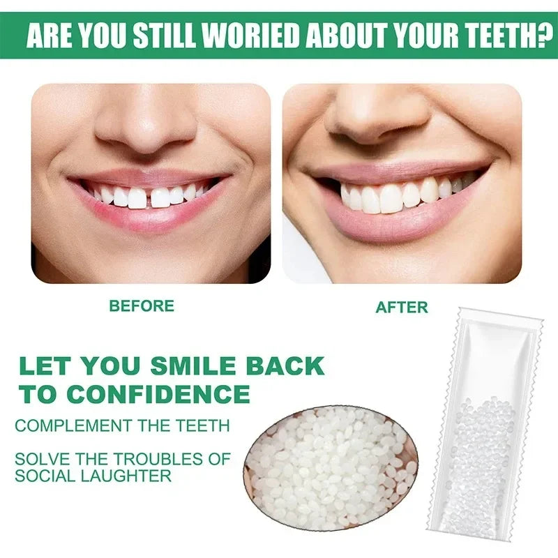 Temporary Tooth Repair Kit – Resin Denture Adhesive & Gap Filler Tooth Repair Kit Oasis Select