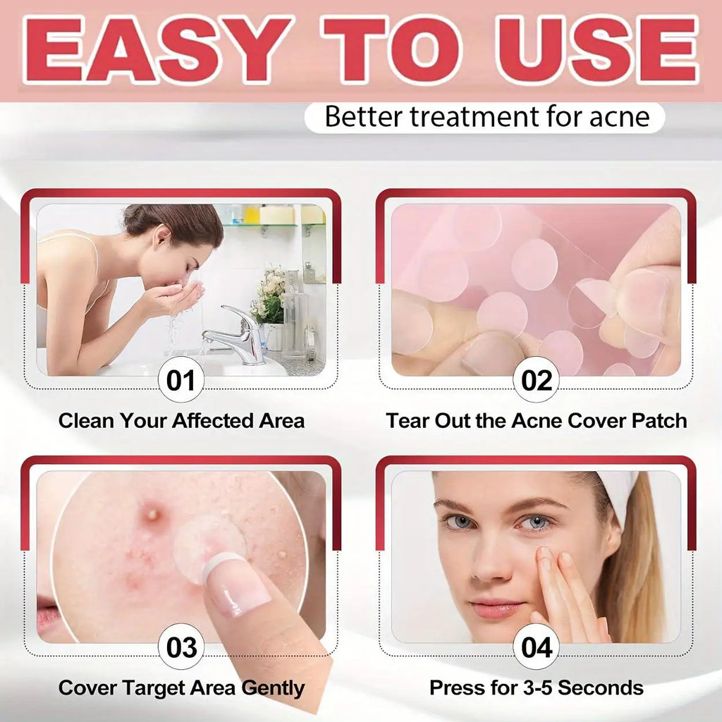 1200/800/400pcs/box hydrocolloid acne patch, alcohol free, mild and non irritating acne patch, suitable for all skin types Oasis Select