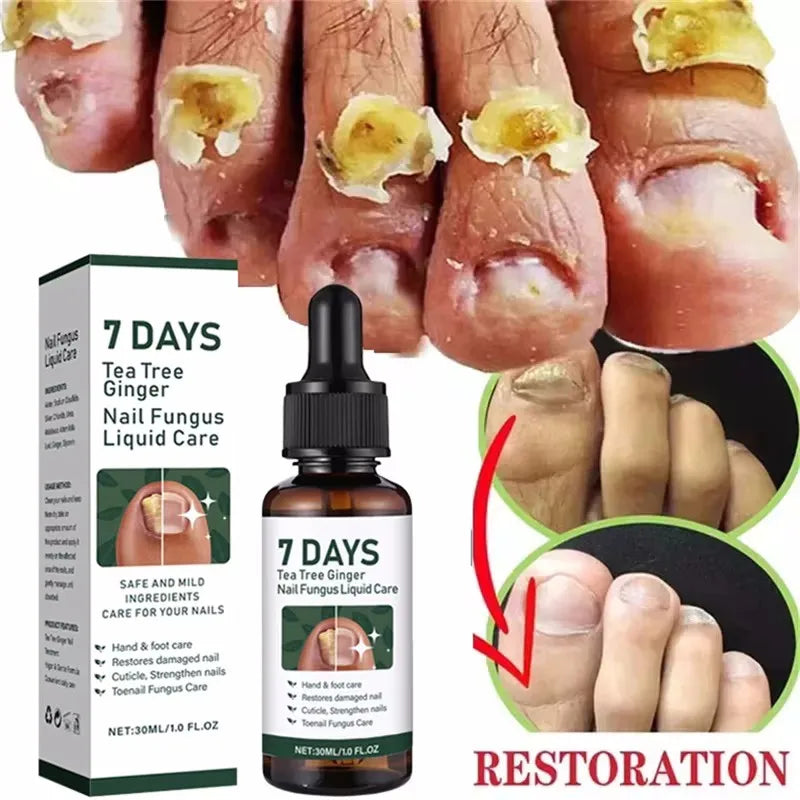 Eelhoe Nail Repair Serum – Ginger Extract for Healthy Nails Nail Repair Serum Oasis Select