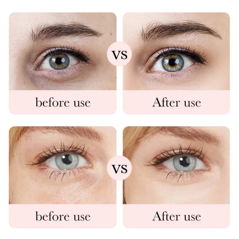 BIOAOUA Rose Hyaluronic Acid Eye Cream for Moisturizes Repairs Lightens Fine Lines Black Circles 20g Oasis Select