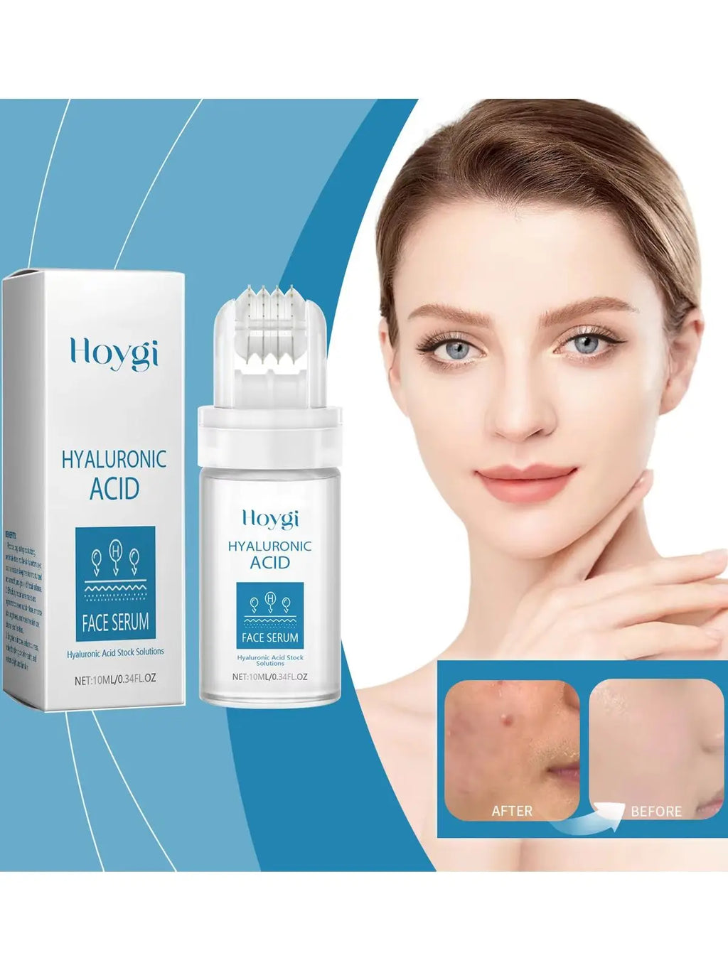 Hyaluronic Acid Microneedle Roller Serum – Brighten & Hydrate Microneedle Roller Serum Oasis Select