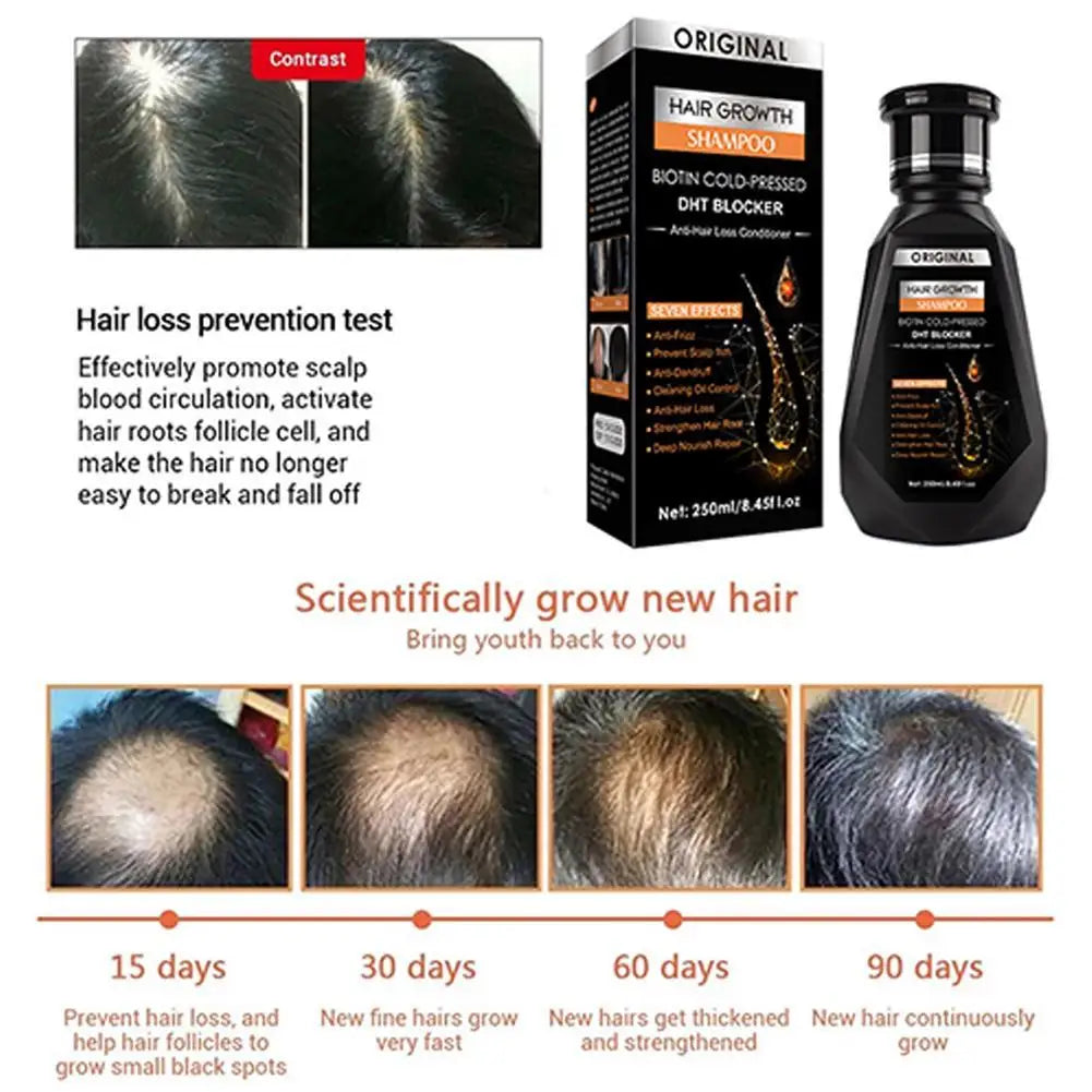 Ginger Hair Growth Shampoo Deep Cleaning Relieves Itching Stimulates Hair Follicles and Accelerates Hair Growth Shampoo Oasis Select