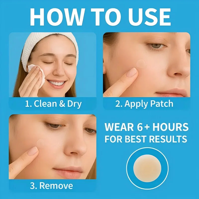 180/360 patches, invisible masking stickers for acne and blemishes - alcohol free, fragrance free, suitable for all skin types Oasis Select