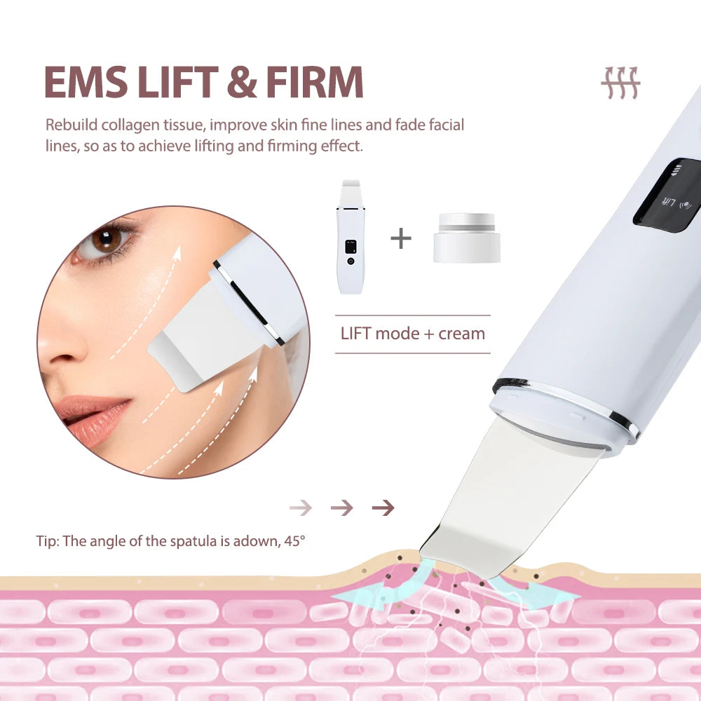 Ultrasonic Skin Scrubber – Blackhead Remover & Pore Cleanser