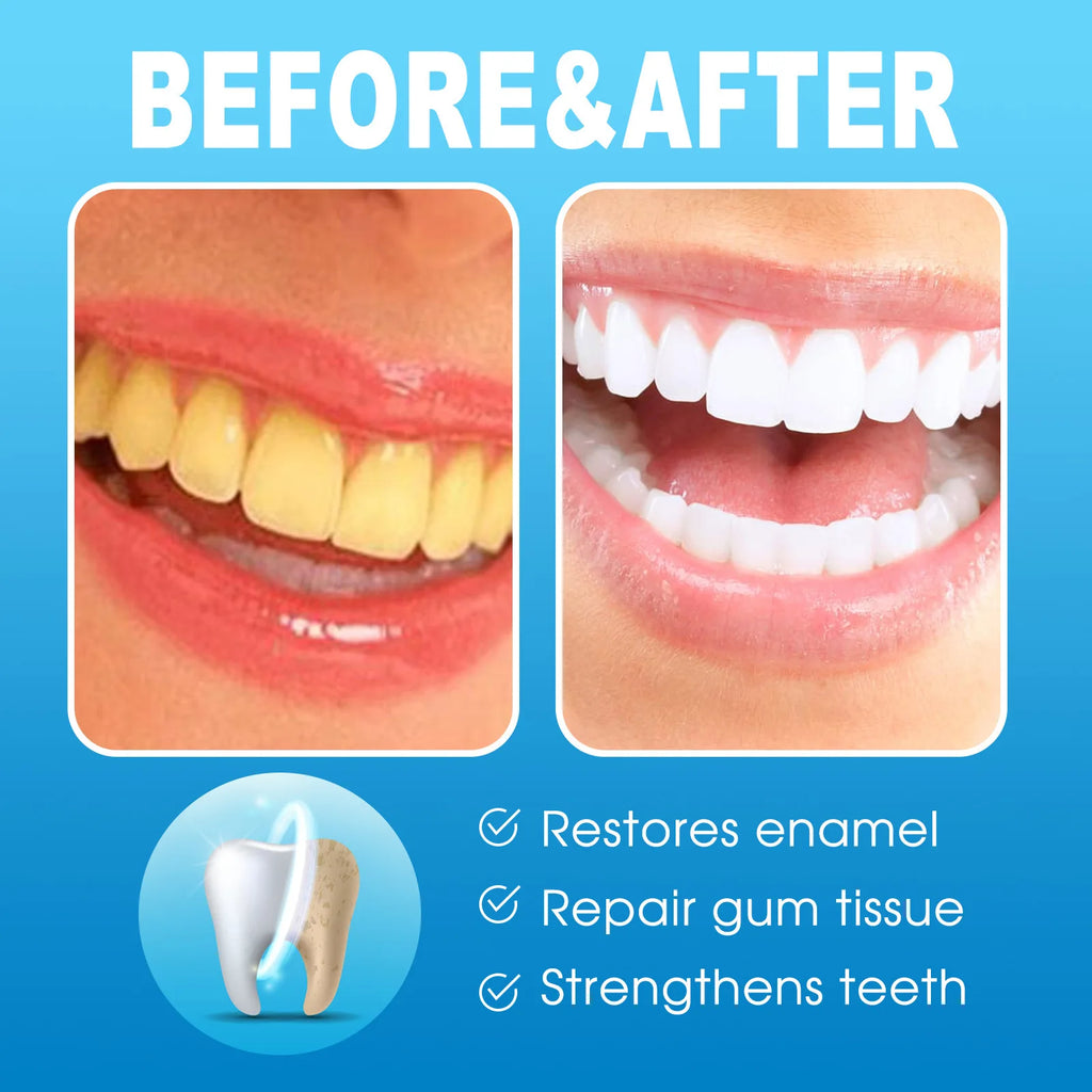 EELHOE Teeth Whitening Gel Pen – Stain Removal & Brightening Teeth Whitening Pen Oasis Select