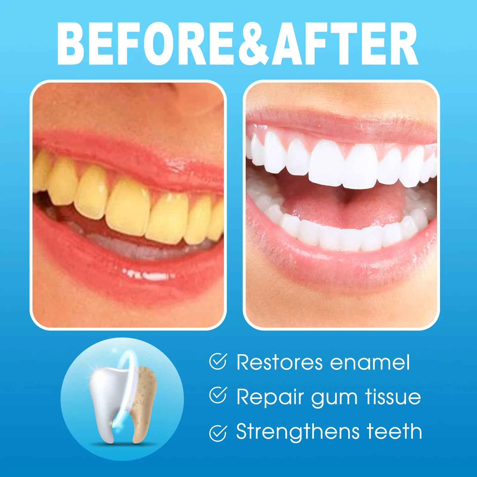 EELHOE Teeth Whitening Gel Pen – Stain Removal & Brightening Teeth Whitening Pen Oasis Select