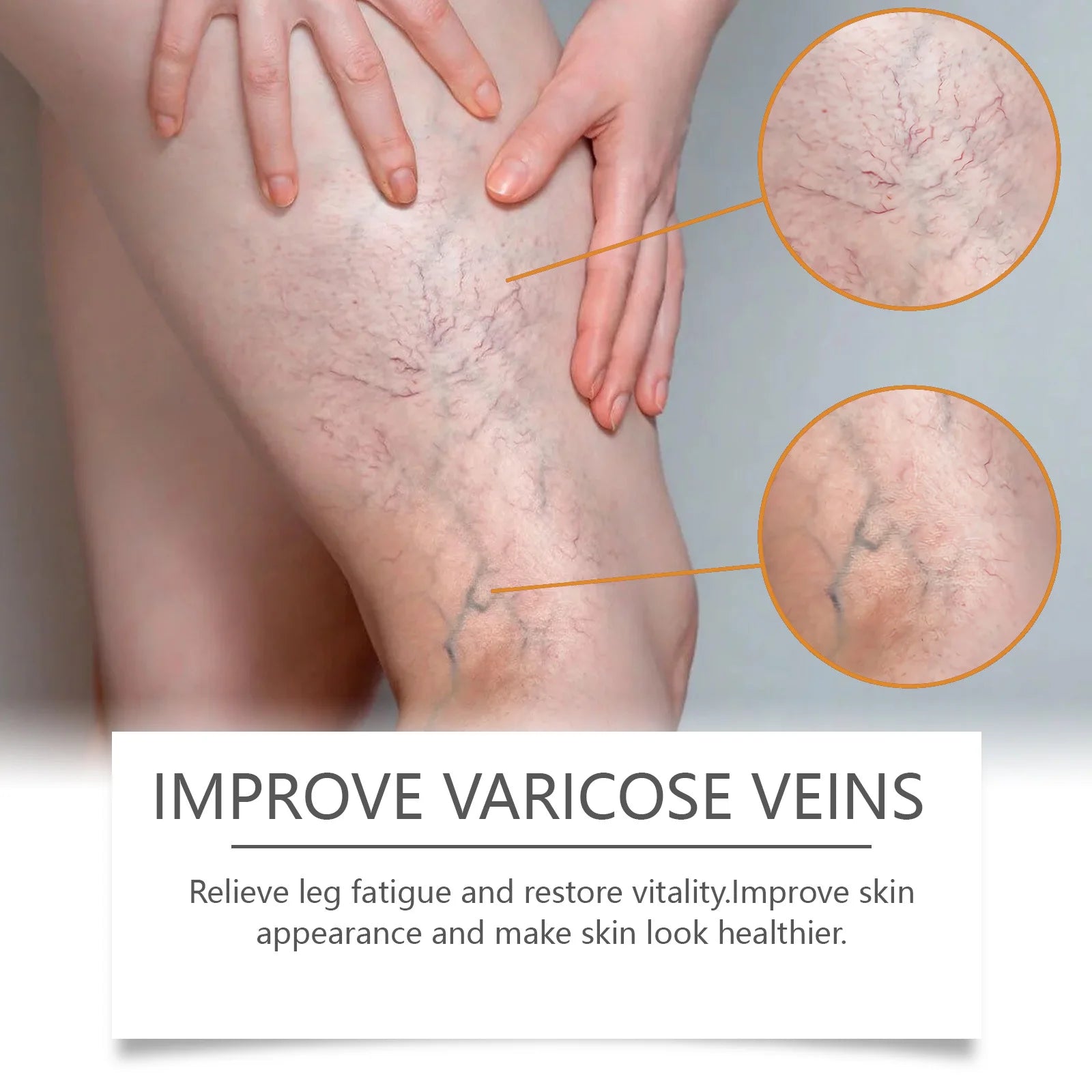 Varicose & Spider Vein Relief Cream – Natural Herbal Ointment Vein Relief Cream Oasis Select