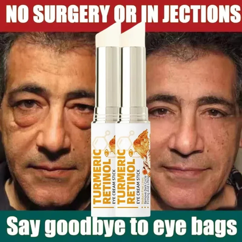 SADOER Retinol Eye Cream – Brighten, Firm & Hydrate Eye Cream Oasis Select