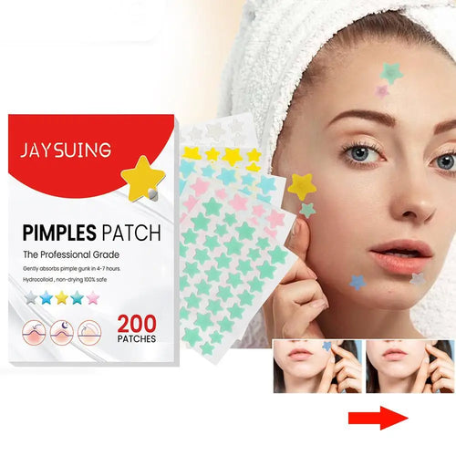 200pcs Star Shape Pimple Patches Colorful Hydrocolloid Pimple Healing Sticker Cute Strong Absorption Zit Patches Face Care Oasis Select