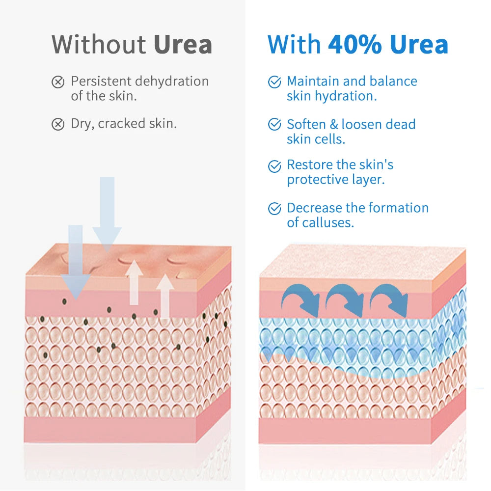 New 42% Urea Cream + 2% Salicylic acid Foot and hand Moisturizer, deep moisturizer and Nourishing moisturizer Oasis Select