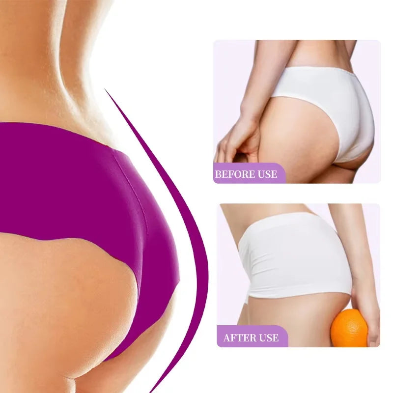 SADOER Buttock Lifting & Firming Cream – Tone & Tighten Body Firming Cream Oasis Select