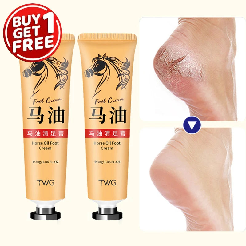 Ma You Qing Moisturizing Foot & Hand Cream – Dry Skin 30g Foot & Hand Cream Oasis Select 2pcs