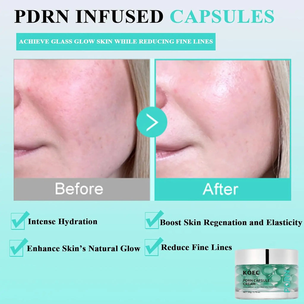 PDRN Capsule Face Cream – Hyaluronic Acid & Peptides 50g