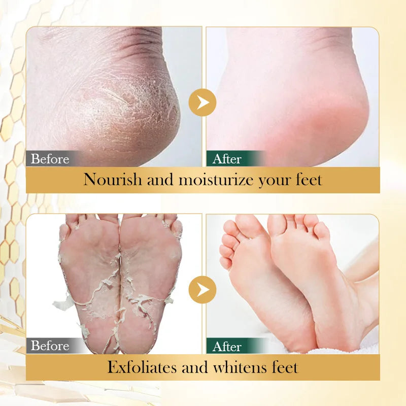 BIOAOUA Vitamin E & Manuka Honey Foot Mask | Deep Moisture Foot Mask Oasis Select