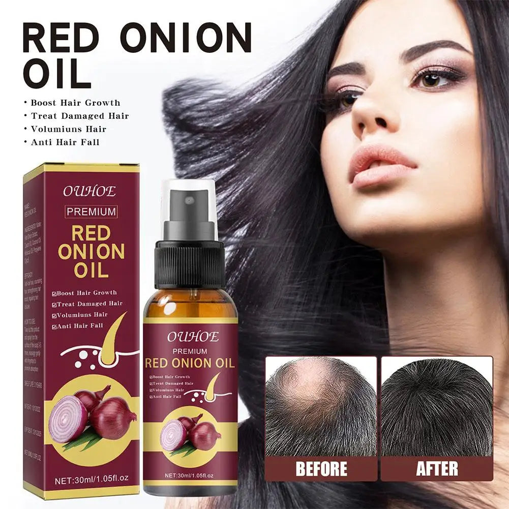 Red Onion Hair Oil Spray – Nourish Roots & Reduce Hair Loss