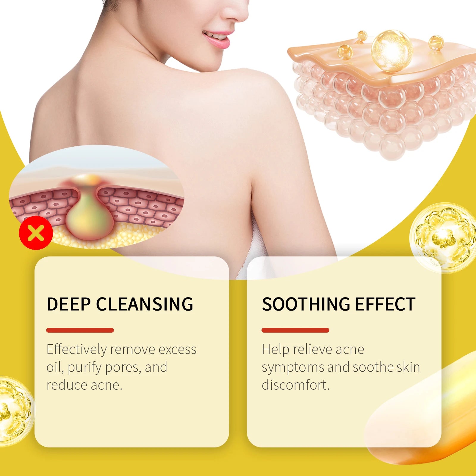 Jaysuing Acne Treatment Soap – Oil Control & Skin Lightening 100g Acne Cleansing Soap Oasis Select