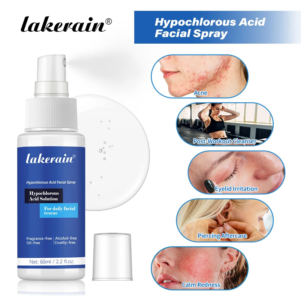 Hypochlorous Acid Facial Spray Reduce Redness Breakouts Soothing For Daily Facial Rescue Calm Redness Skin Care Products Oasis Select