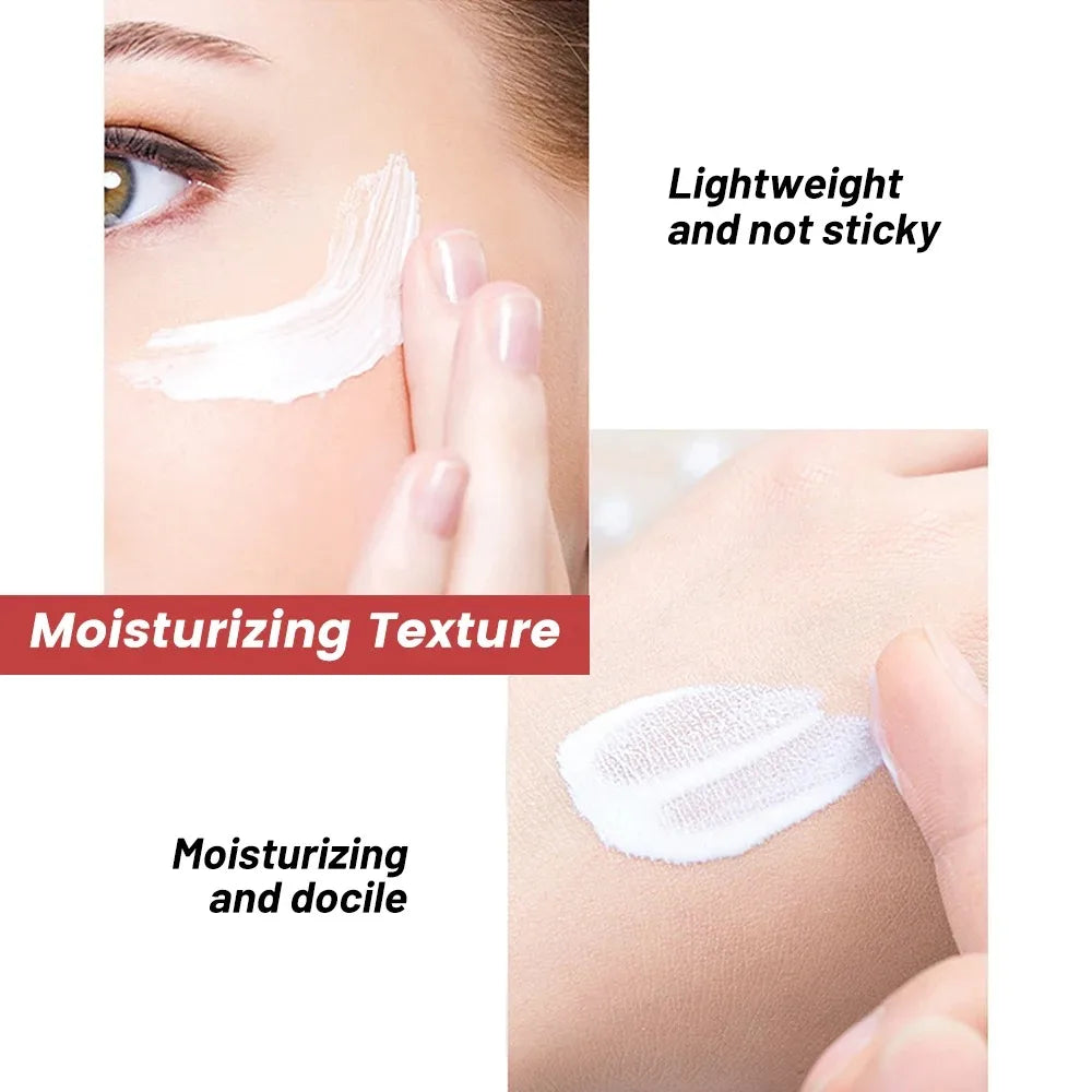 20g Whitening Freckle Cream Remove Dark Spot Cream Anti Freckle and Aging Cream Fade Pigmentation Melasma Brighten Serum Skin Oasis Select
