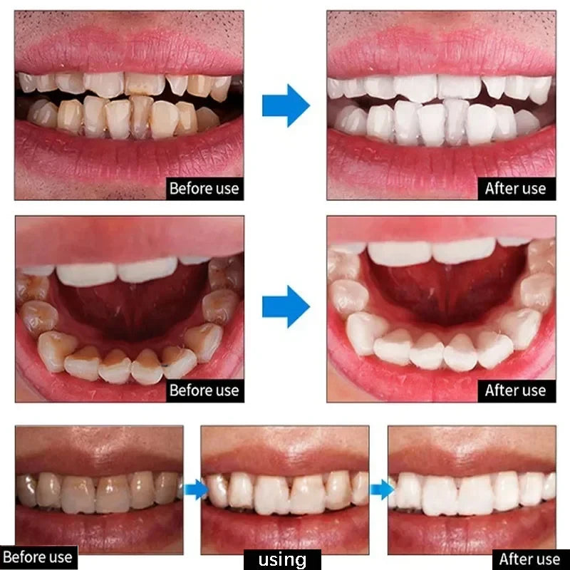 V34 Whitening Toothpaste 2-Pack | Stain Removal & Fresh Breath