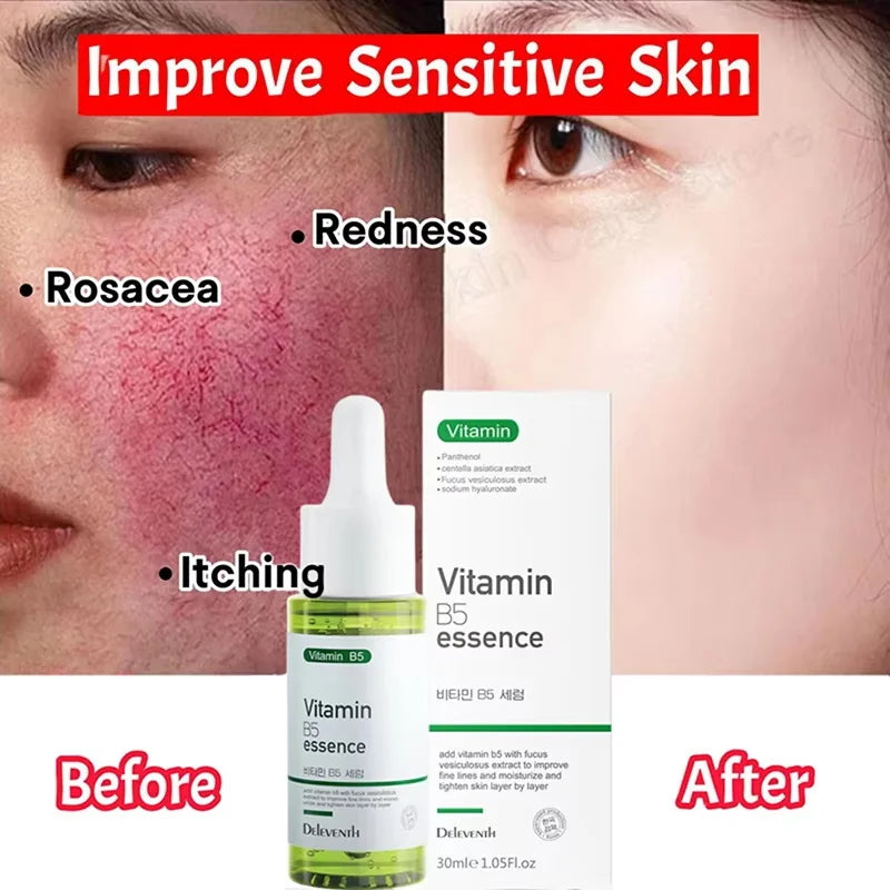 SADOER Calming Face Serum – Sensitive Skin & Pore Minimizer Face Serum Oasis Select