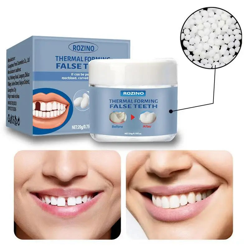 Moldable Tooth Repair Kit – Temporary Filling & False Teeth
